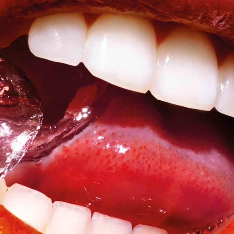 Dental
