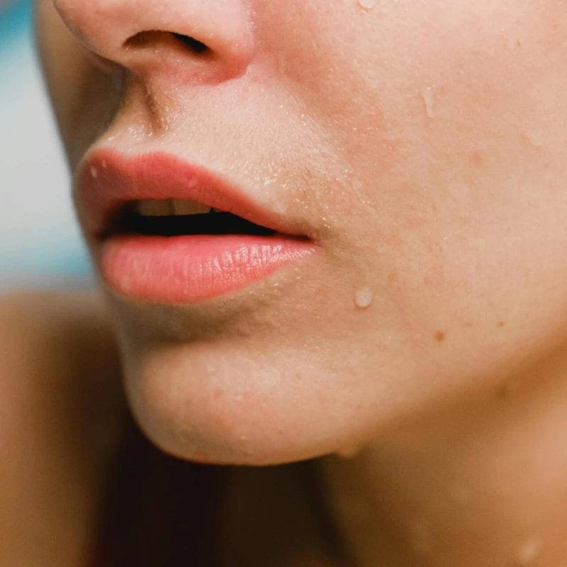 SkinPen: Inovativni tretman mikroiglicama koji obnavlja kožu iznutra