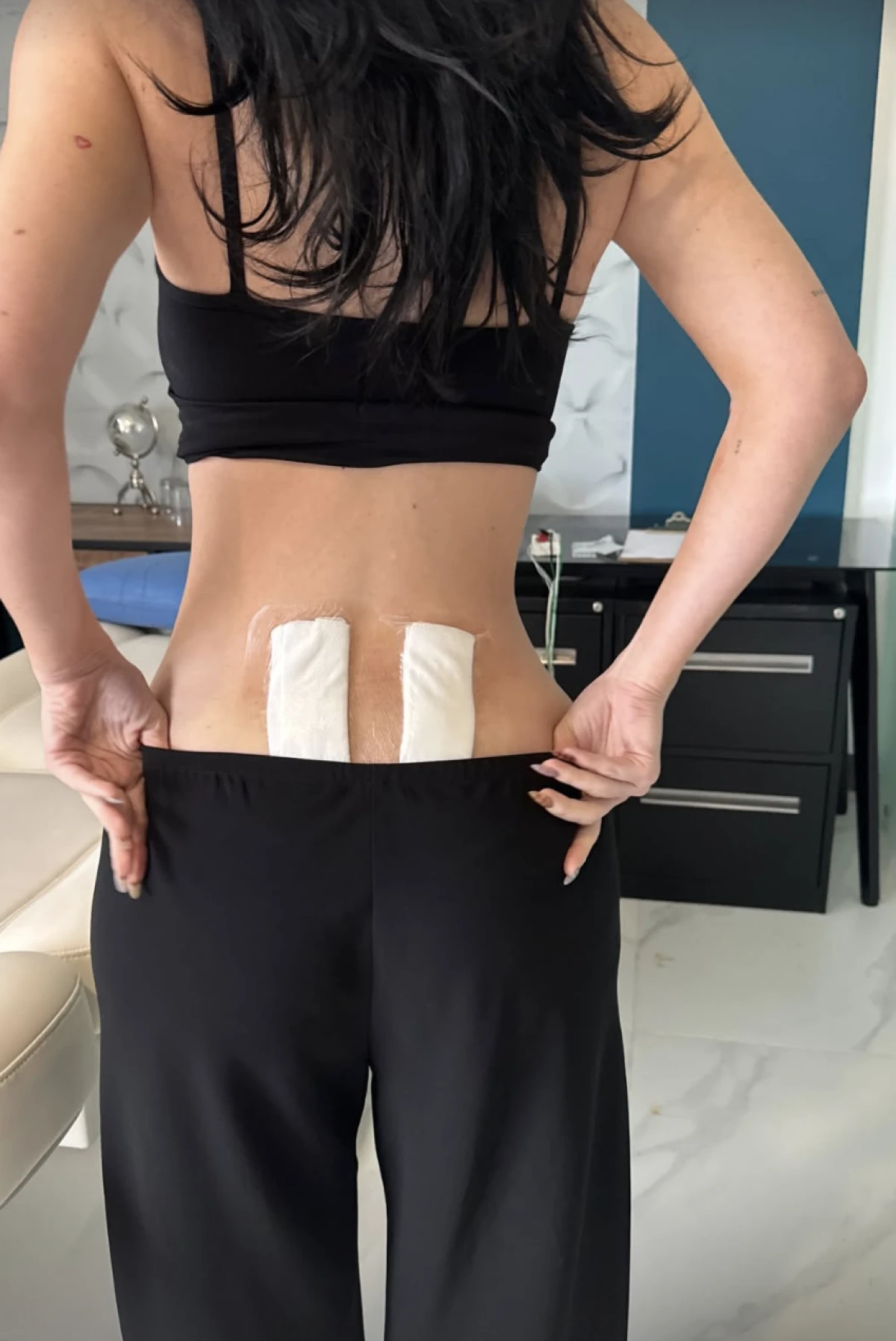 Kylie Jenner otkrila zdravstvene probleme s kojima se suočila nakon trudnoća