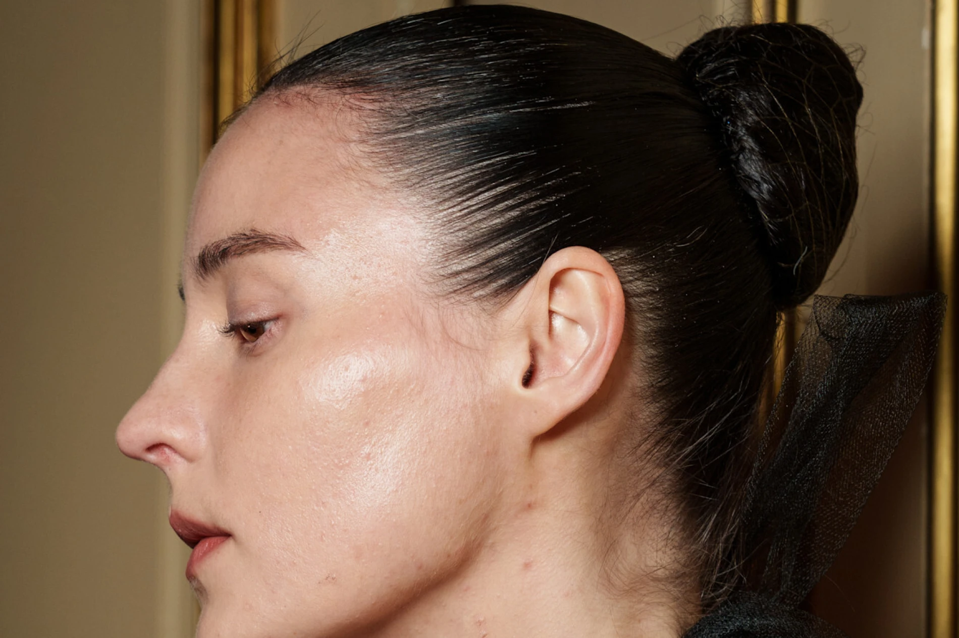 Va&scaron; &ldquo;nerje&scaron;iv&rdquo; problem s aknama možda ima jednostavno zimsko rje&scaron;enje