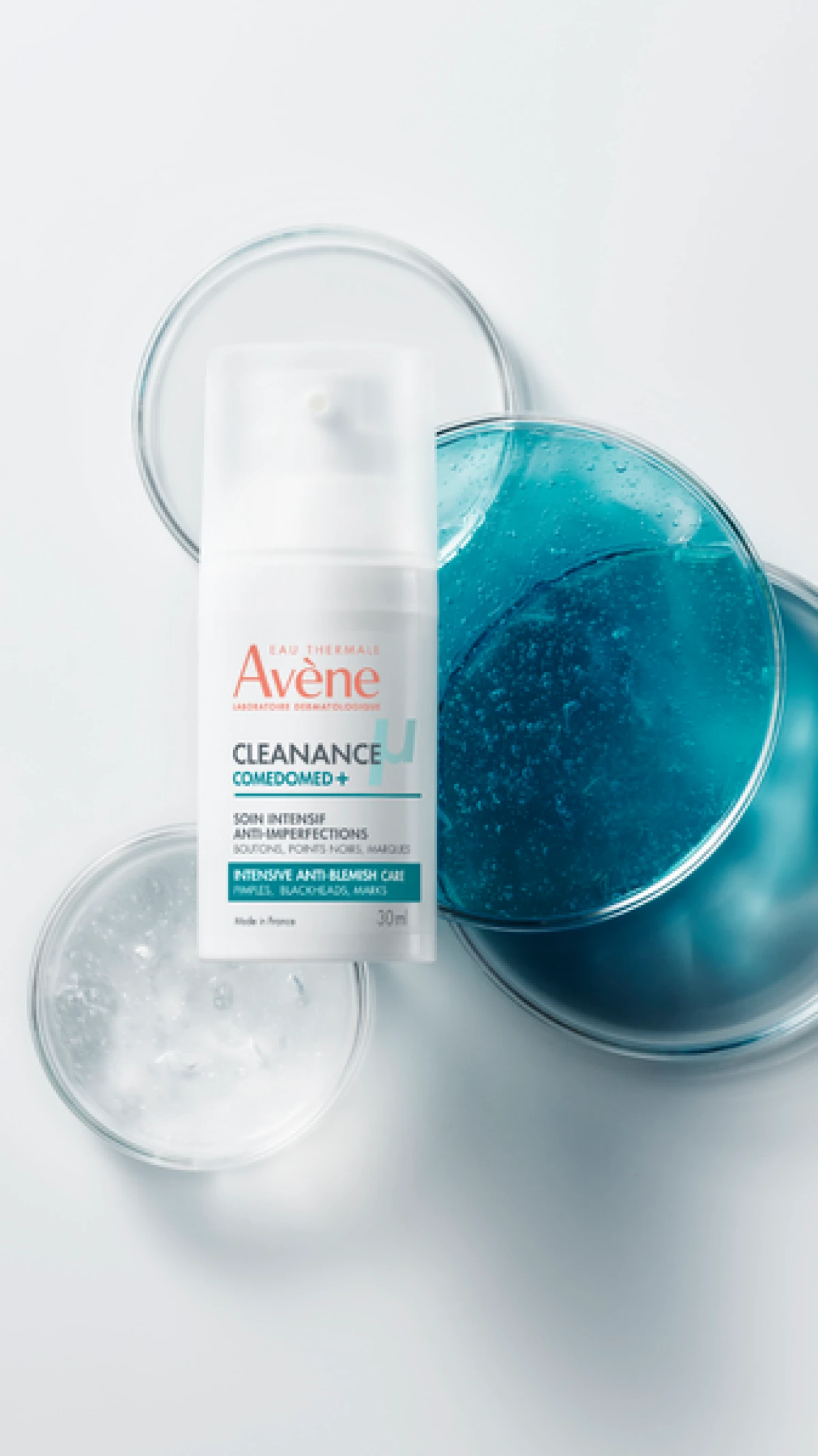 Va&scaron; &ldquo;nerje&scaron;iv&rdquo; problem s aknama možda ima jednostavno zimsko rje&scaron;enje