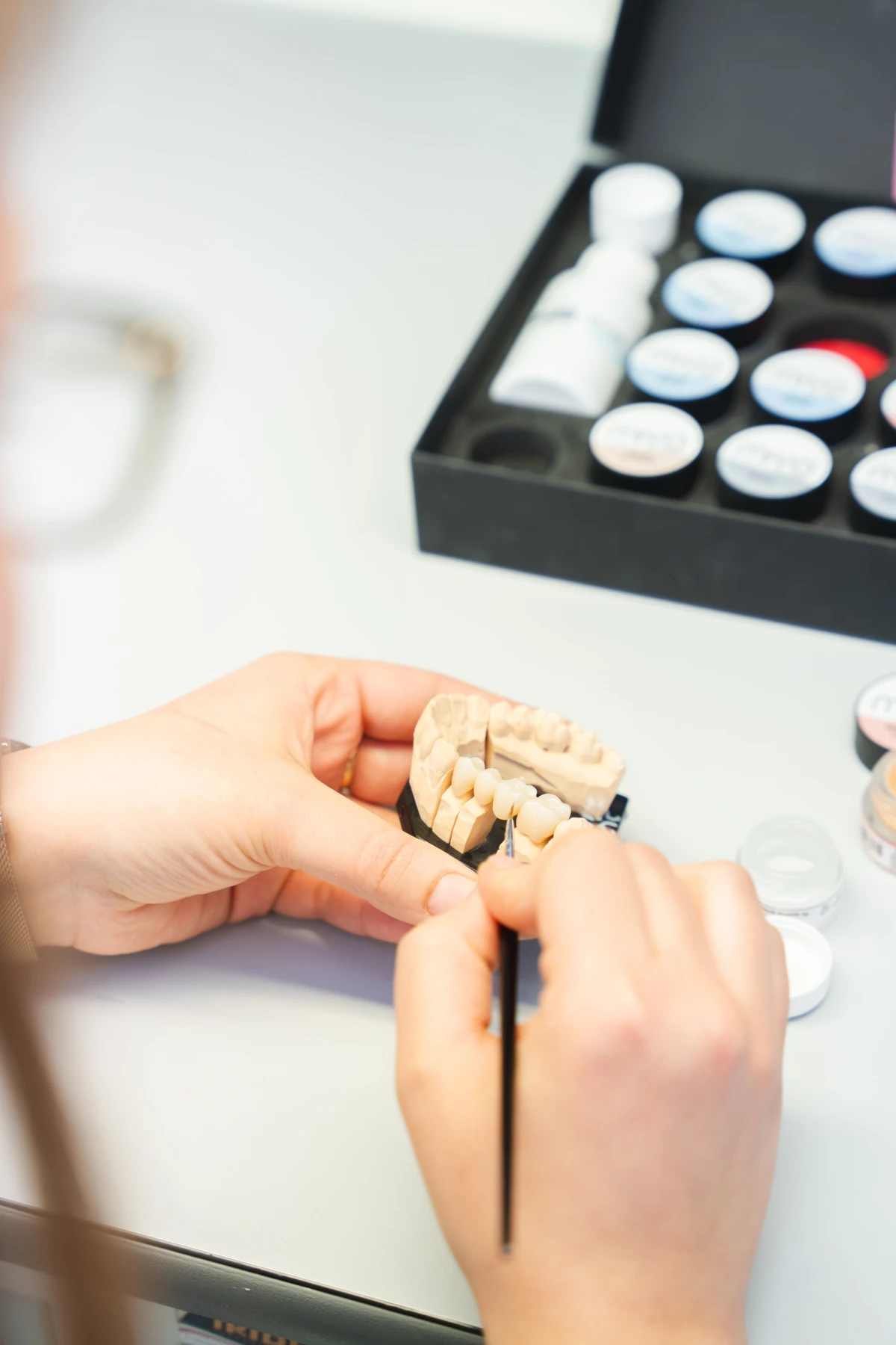 Tim Poliklinike Apolonia iz Labina otkriva tajne savr&scaron;enog osmijeha