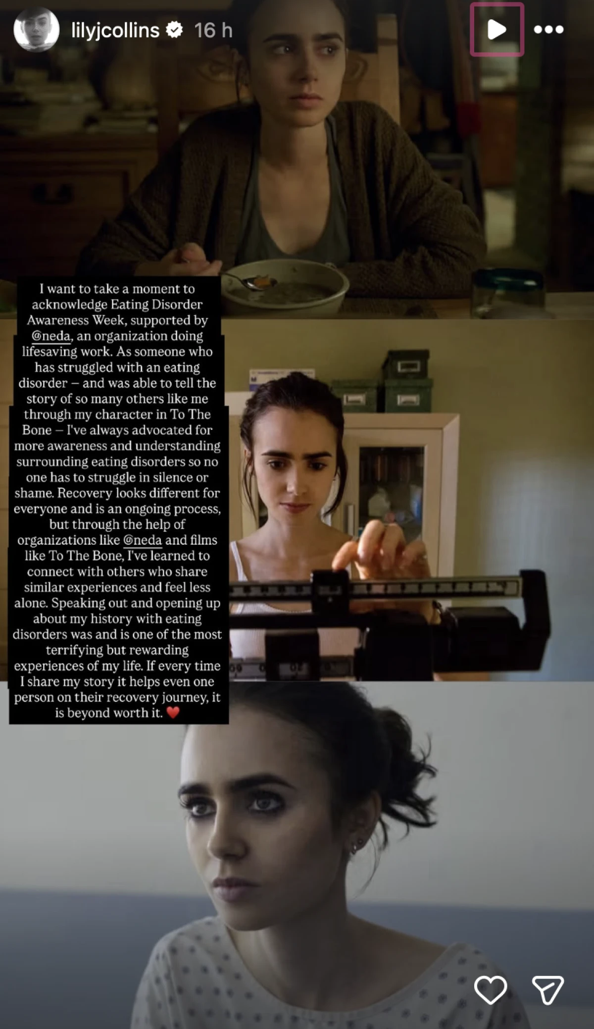 Lily Collins o pobjedi nad poremećajem prehrane: &bdquo;Najstra&scaron;nije je bilo progovoriti"