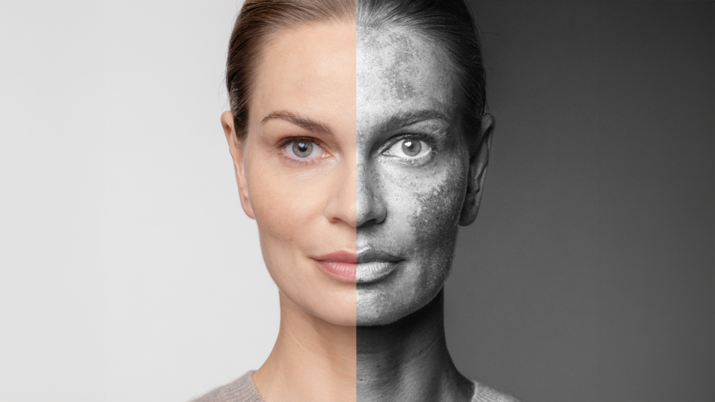 Eucerin Anti-Pigment rutina protiv hiperpigmentacija